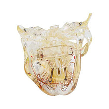 Load image into Gallery viewer, Health beautifteeth Transparent Pathologies Dental Model with Nerve Caries Implant and Pulp for Demonstration
