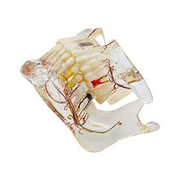 Health beautifteeth Transparent Pathologies Dental Model with Nerve Caries Implant and Pulp for Demonstration